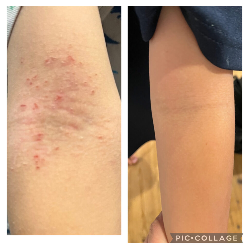 LalaMarjoram | アロマテラピー広島